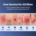 BiteRelieve image
